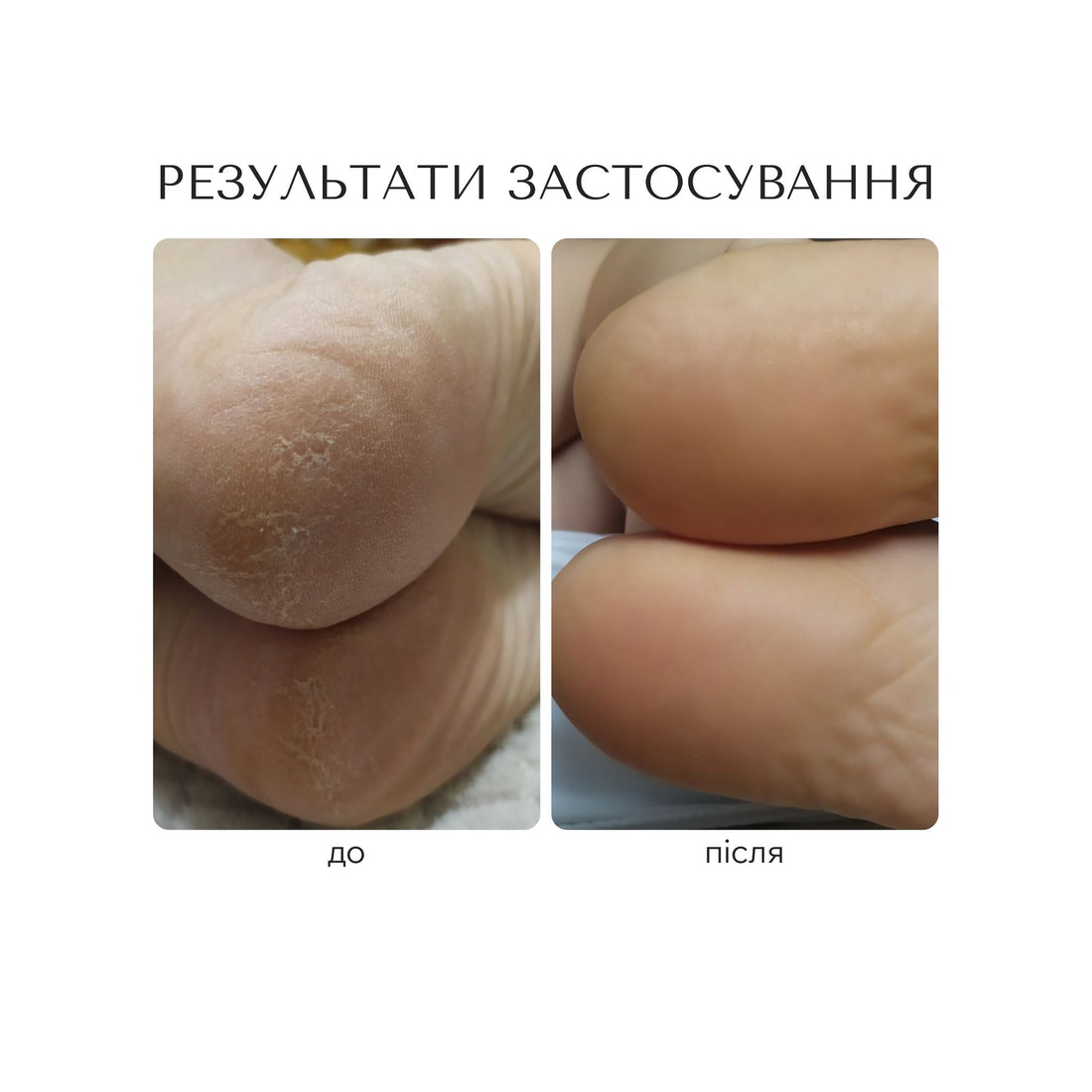 ПОМ&