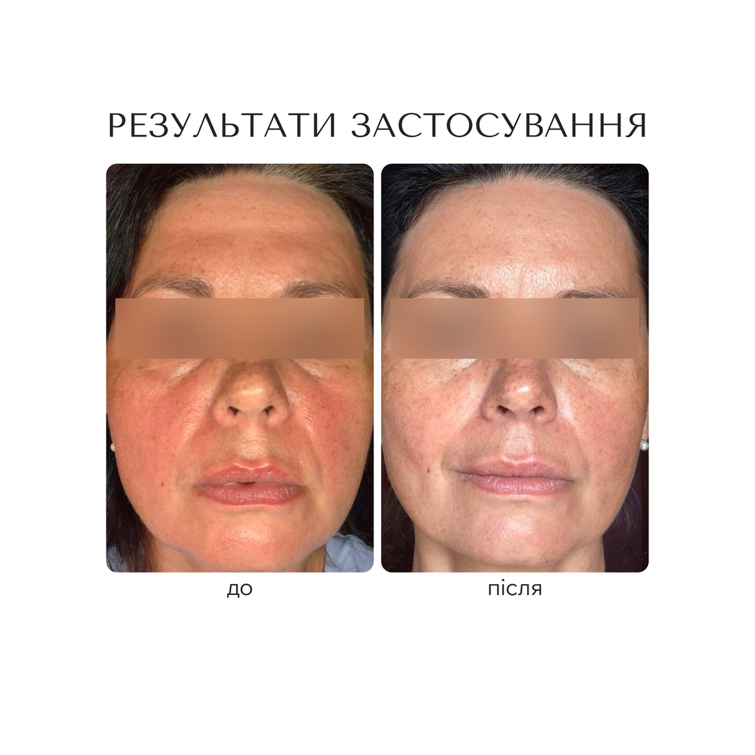 РЕВІТАЛІЗУЮЧА СИРОВАТКА ДЛЯ ОБЛИЧЧЯ "ANTIOXIDANT LONGEVITY"