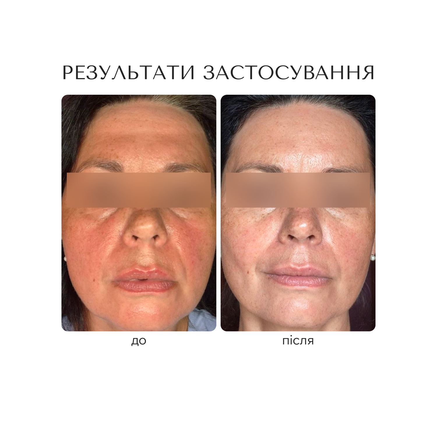 РЕВІТАЛІЗУЮЧА СИРОВАТКА ДЛЯ ОБЛИЧЧЯ "ANTIOXIDANT LONGEVITY"