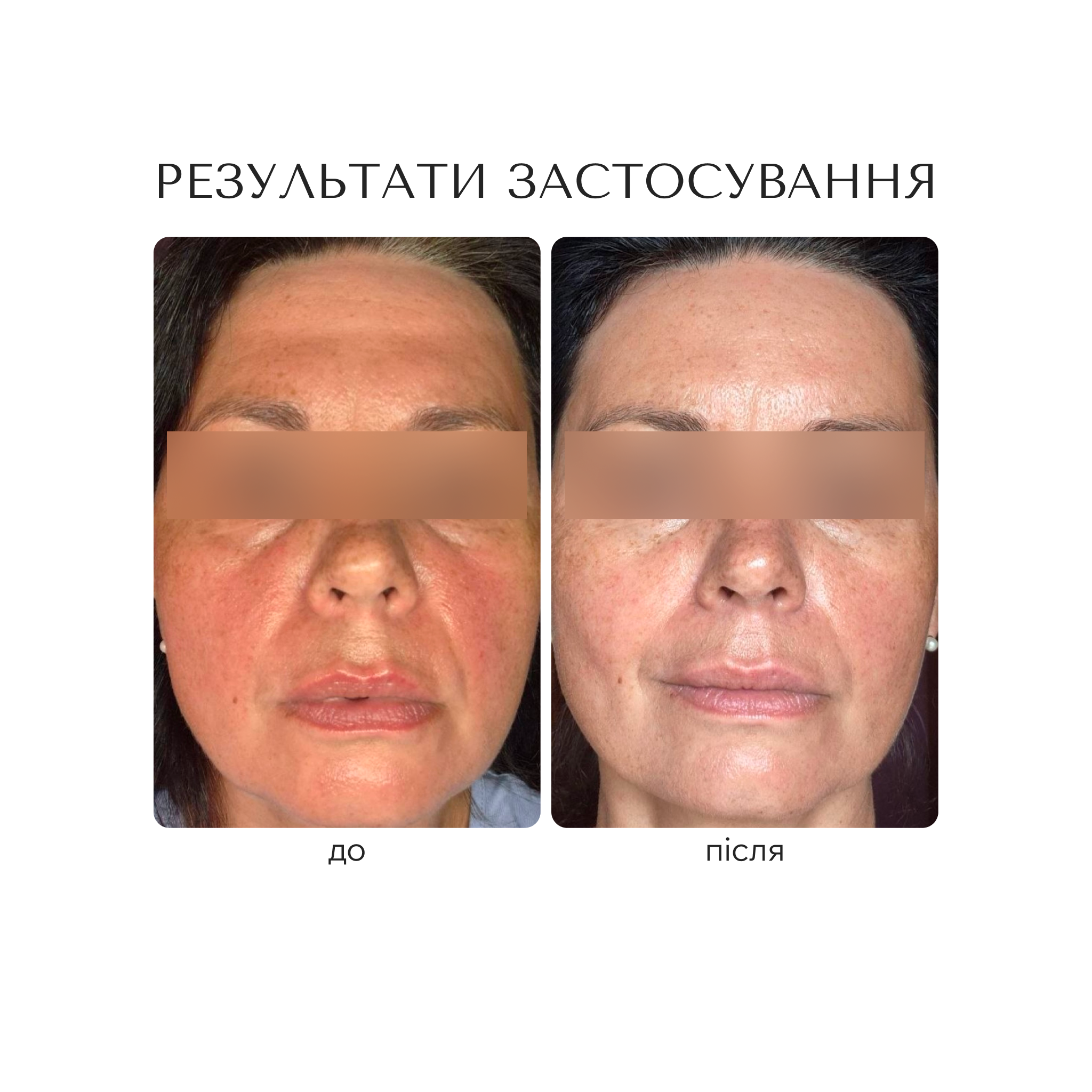 РЕВІТАЛІЗУЮЧА СИРОВАТКА ДЛЯ ОБЛИЧЧЯ "ANTIOXIDANT LONGEVITY"