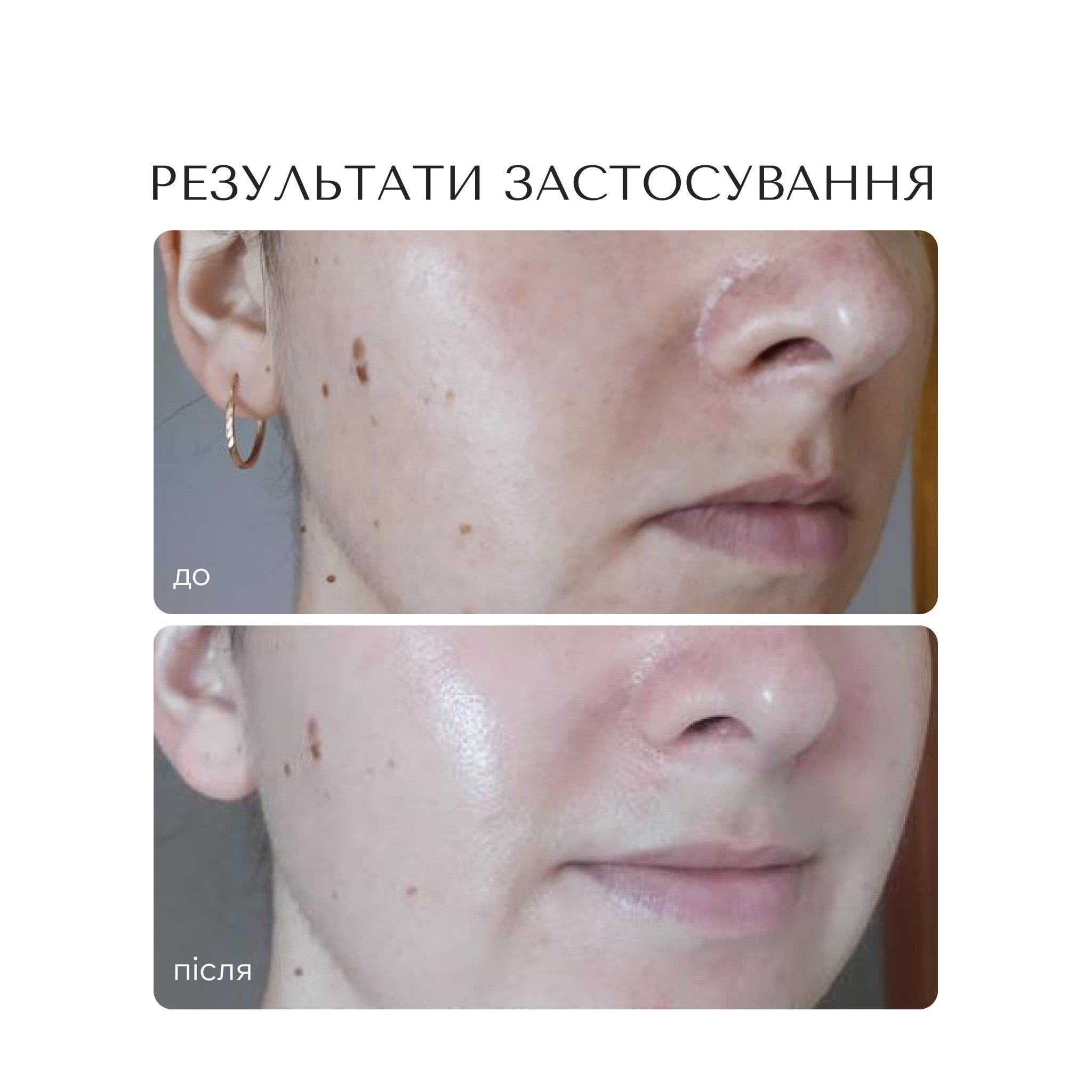 СИРОВАТКА-КОРЕКТОР ДЛЯ ОБЛИЧЧЯ "EVENTONE BRIGHTENING"
