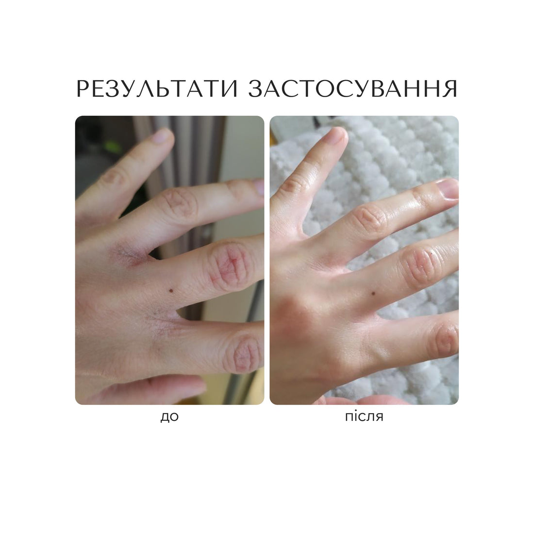ВІДНОВЛЮЮЧИЙ КРЕМ ДЛЯ РУК "CERAMIDE INTENSE"