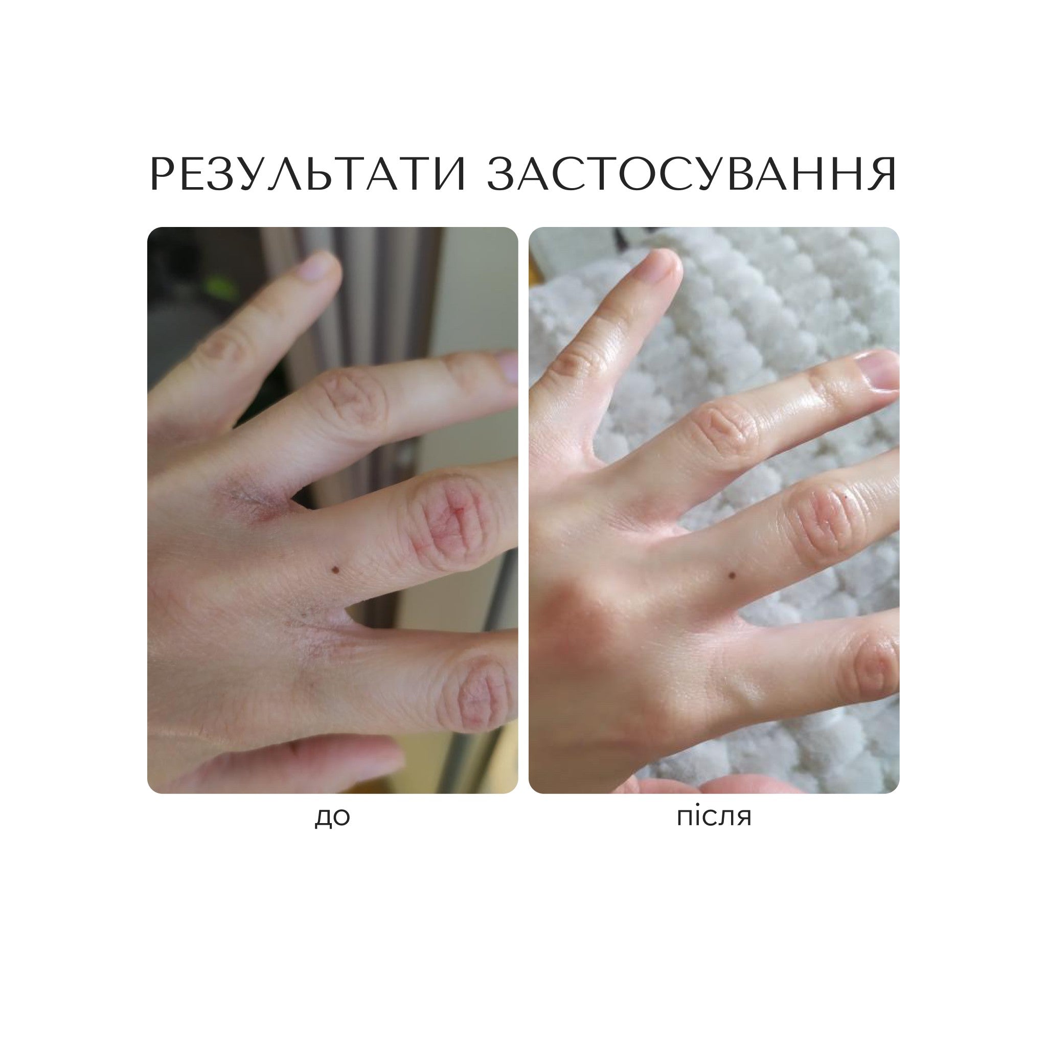 ВІДНОВЛЮЮЧИЙ КРЕМ ДЛЯ РУК "CERAMIDE INTENSE" (charity)